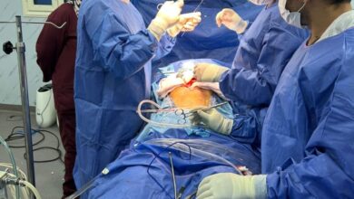 نجاح 3 جراحات عالية الخطورة  بقسم القلب المفتوح بالزقازيق