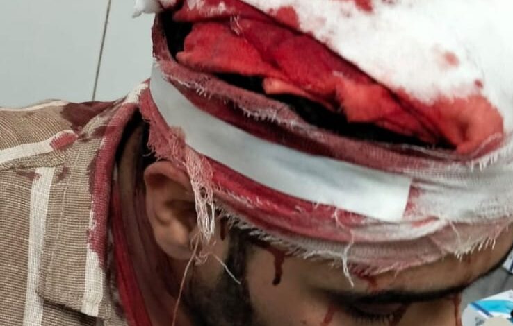 أعمال الهدم تمت بالمخالفة...إصابة شاب إثر سقوط سور محلج الفشن عليه